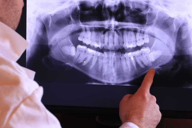 Best Emergency Dental Surgery in Newcastle, WA